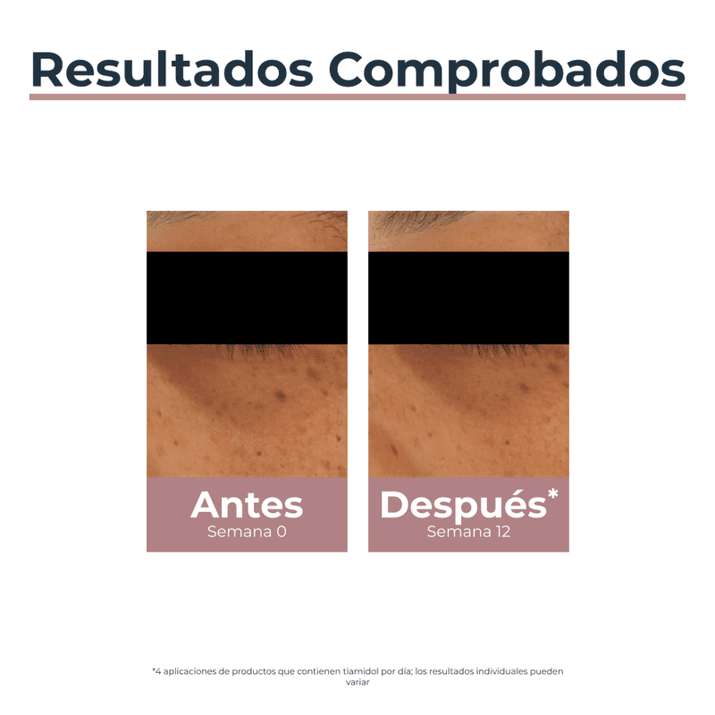 Anti-Pigment Contorno De Ojos Anti-Ojeras Todo Tipo De Piel x 15ml.