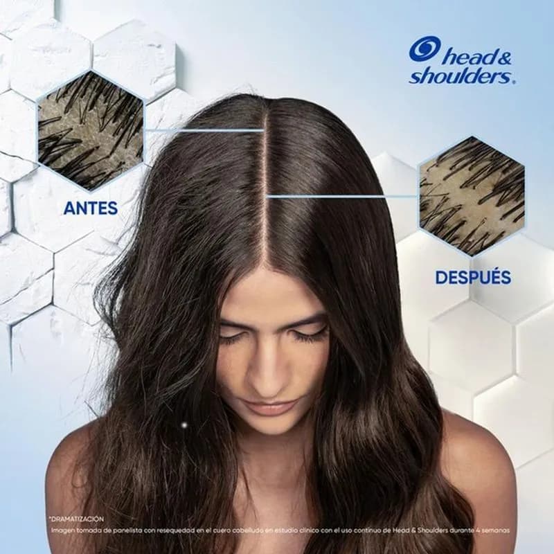 HEAD & SHOULDERS Shampoo Anti-Resequedad x 375ml.