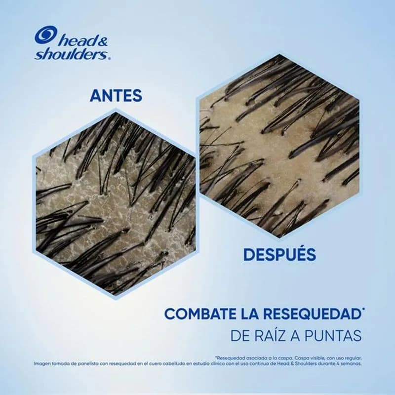 HEAD & SHOULDERS Shampoo Anti-Resequedad x 375ml.